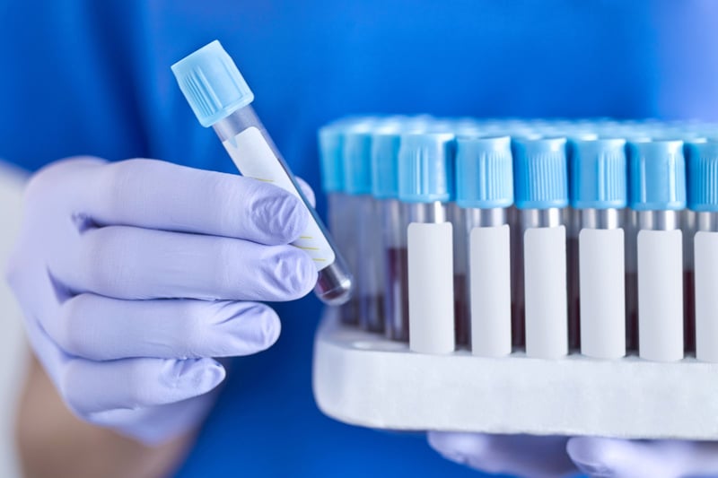 A gloved hand holding blood sample tubes